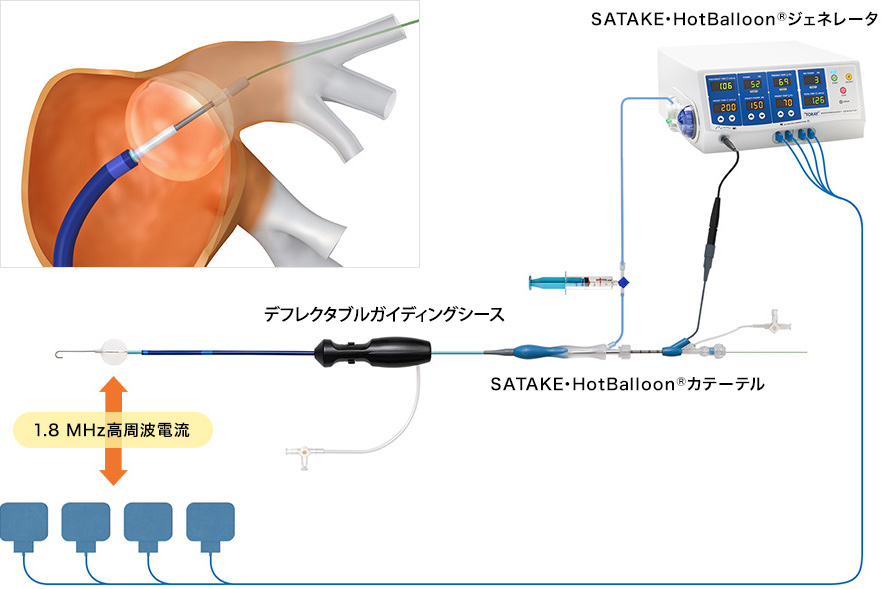 システム概要