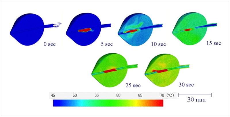 Results of the simulated agitation of the fluid inside the balloon