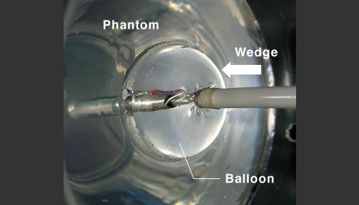 Ablation experiment using a thermoresponsive gel
