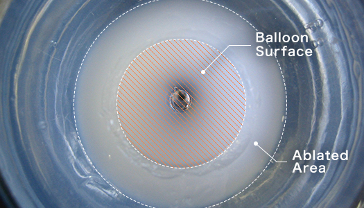 Ablation experiment using a thermoresponsive gel